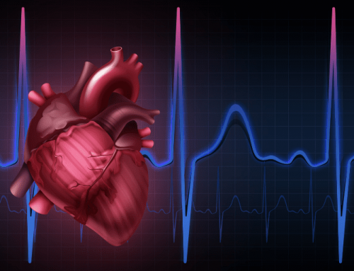 Cardiac Arrhythmias Guide: Types, Symptoms, and Diagnosis